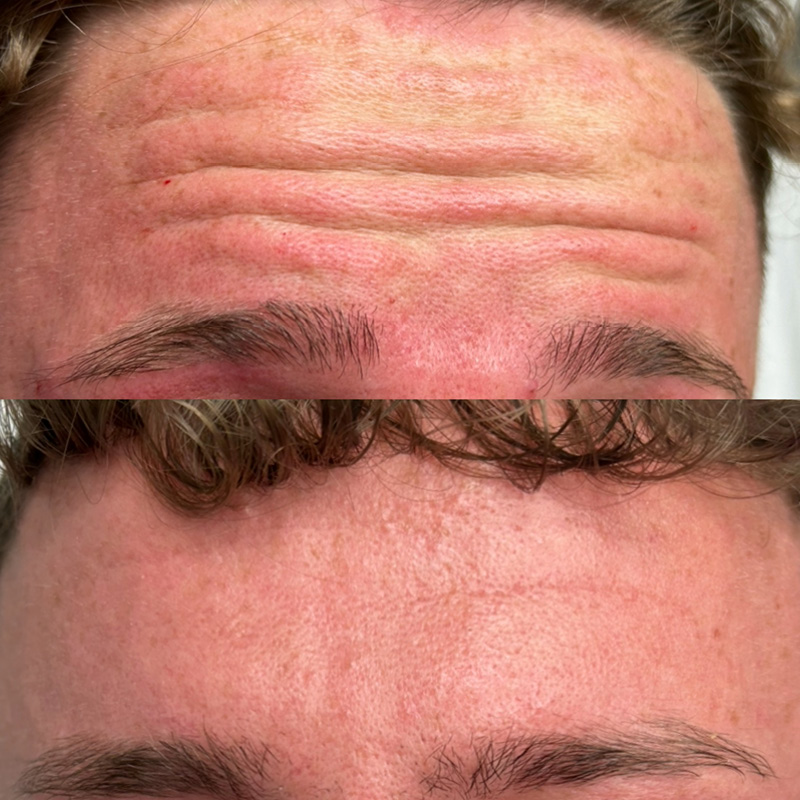 Male Anti Wrinkle treatments from 6 Clinic2